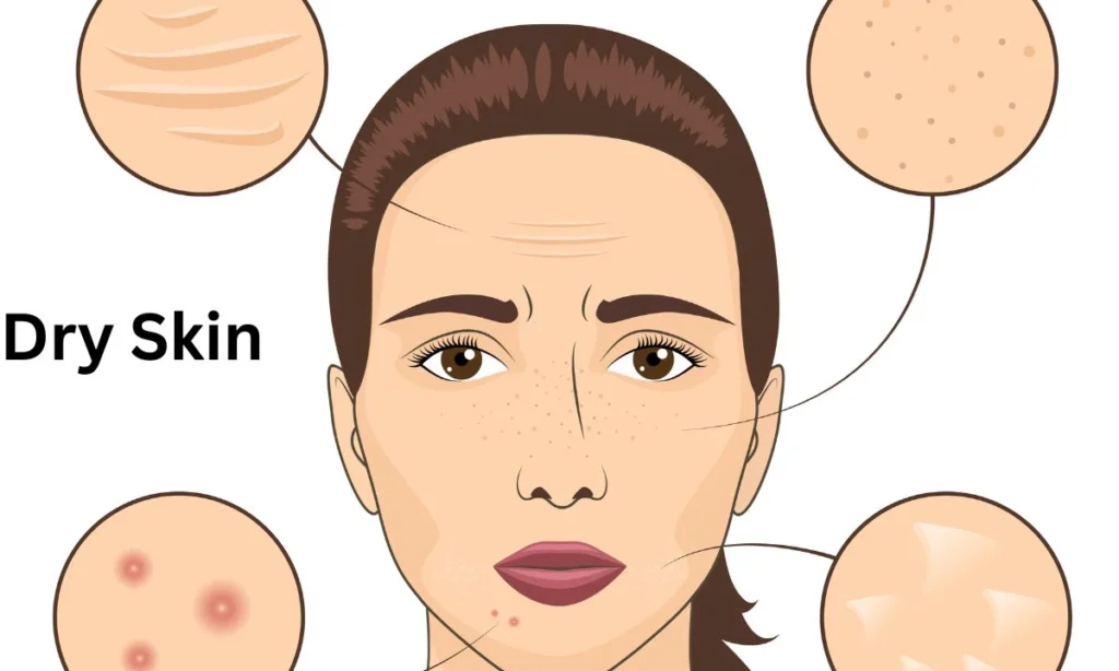 Girls Face With Dry Skin Sagging And Blemishes