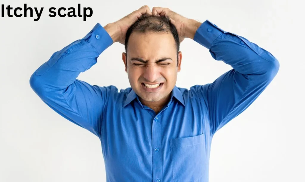 Itchy Scalp